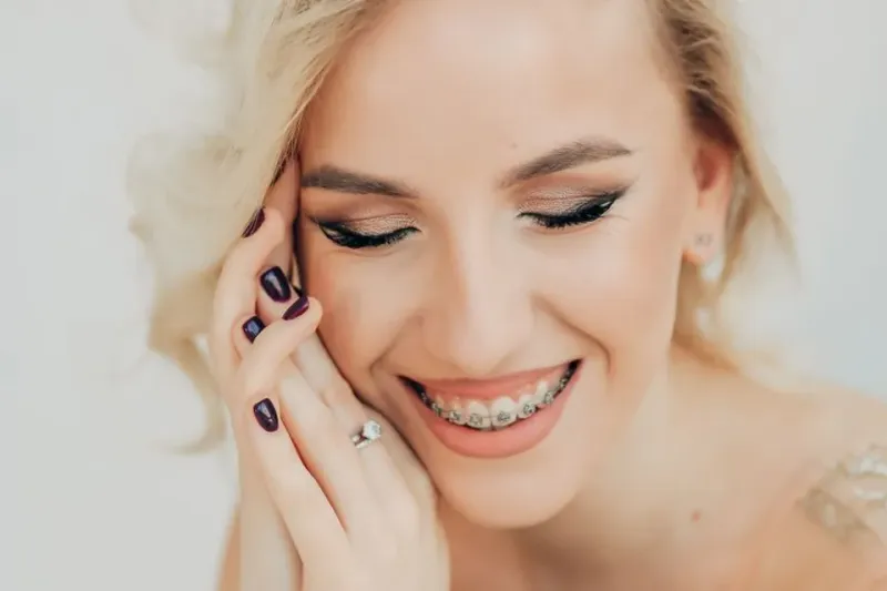 A close-up of a smile wearing braces